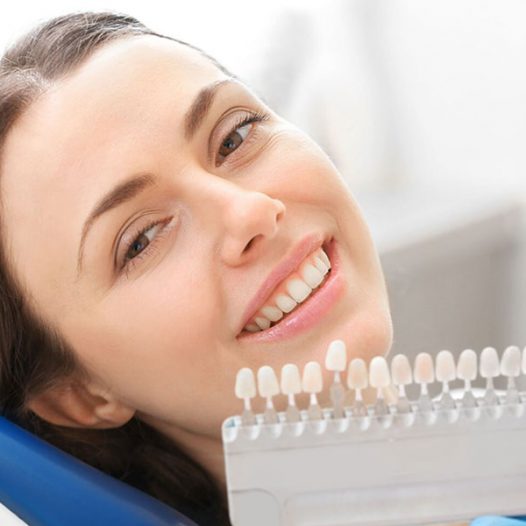 5 Factors to Consider Before Choosing a Dental Crown