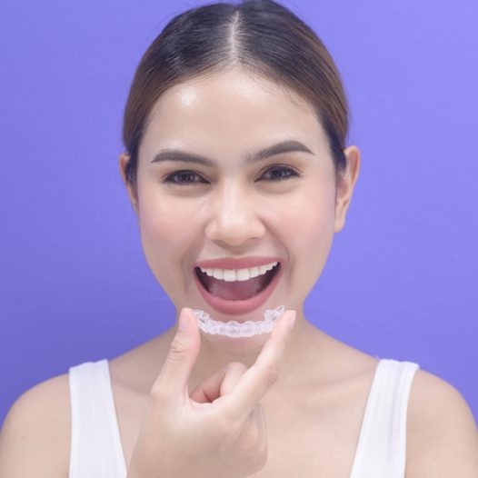 What Are Invisalign Clear Aligners?
