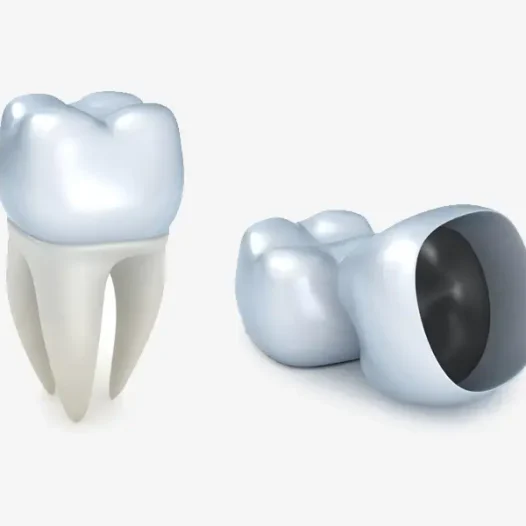 Why Choose Dental Crowns in Houston